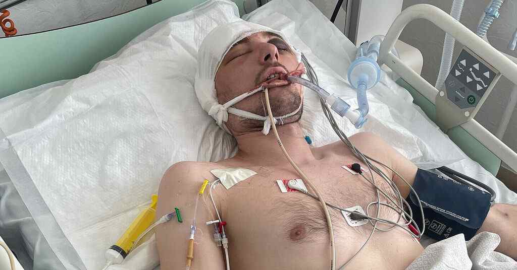 Помер чоловік з Волині, який після мобілізації опинився в реанімації