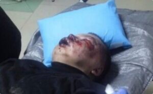 Командир «Вовків Да Вінчі» відреагував на побиття та викрадення 20-річного хлопця у Шахтарському: деталі