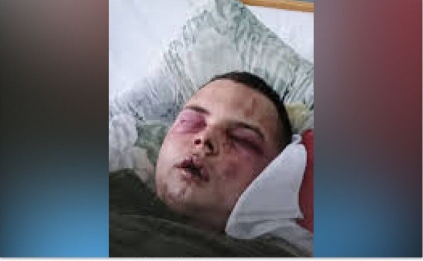 У Шахтарському військові «Вовків Да Вінчі» жорстоко побили та викрали 20-річного хлопця: суд відправив підозрюваних під варту